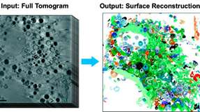 Die Abbildungen zeigen einen Teil einer tiefgefrorenen Säugetier-Zelle. Links ist ein Schnitt aus dem 3D-Röntgentomogramm dargestellt (Skala: 2 μm). Die rechte Abbildung zeigt das rekonstruierte Zellvolumen nach Anwendung des neuen Algorithmus.