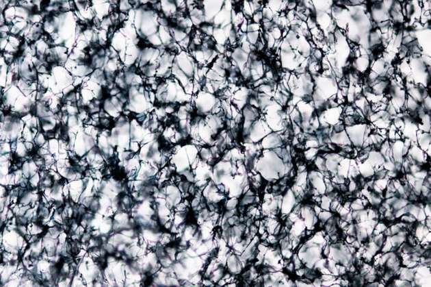 Vergrößertes Bild des leitfähigen Polymer-Zellulose-Aerogels, das die Makrostruktur des Aerogels mit verschiedenen Poren zeigt. PEDOT:PSS und Zellulose waren homogen im Aerogel verteilt.