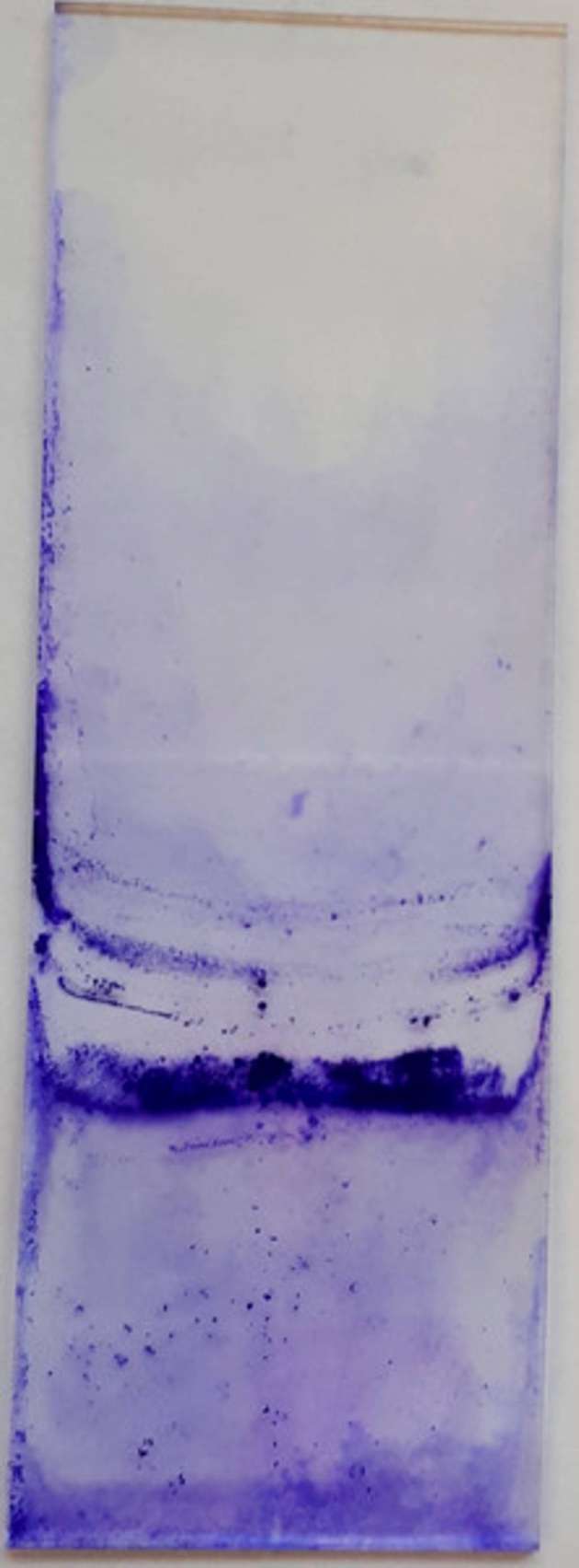 Der Erreger Pseudomonas simiae auf einem Glasträger